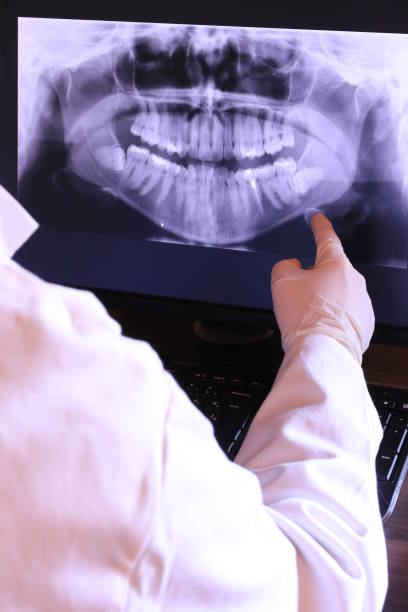Best Urgent Dental Care in Iowa City, IA